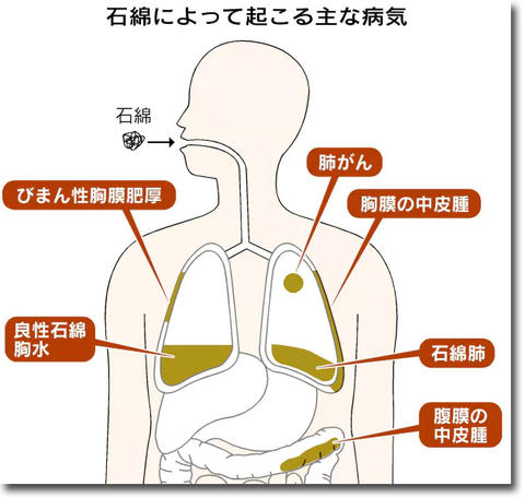 知らずに吸い込むアスベスト