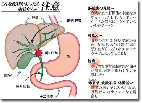 胆管ガンの治療