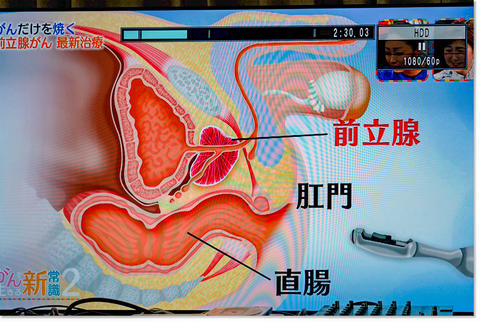 ガン治療は進歩しているのか？